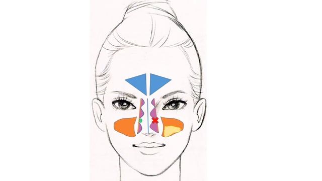 Синусит. Почему возникает? Нужно ли бояться прокола? Осложнения синусита. смотреть онлайн