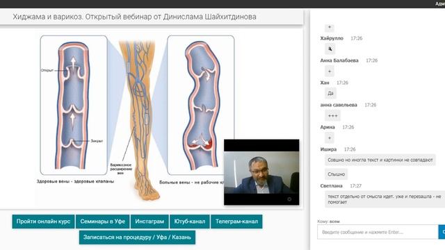 ХИДЖАМА: ВАРИКОЗ / ПРИЧИНЫ / ПРОФИЛАКТИКА / ПОСЛЕДСТВИЯ ВАРИКОЗА / РАЗБОР ВОПРОСОВ
