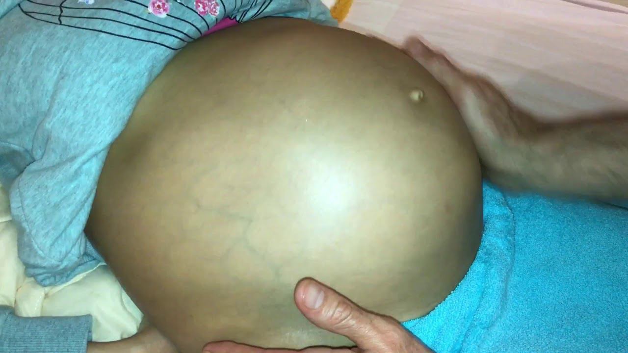КАК БЫСТРО УБРАТЬ ОТЁЧНОСТЬ НОГ И БОЛИ В ЖИВОТЕ НА ПОСЛЕДНЕМ СРОКЕ БЕРЕМЕННОСТИ! СтопАптека!