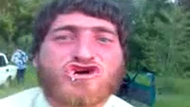 чеченец плюется какашками смотреть онлайн