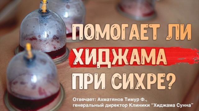 Помогает ли Хиджама при сихре? | Ахматянов Тимур | II Конференция специалистов по хиджаме