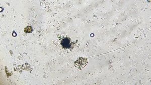 Инфузория Сувойка активно охотиться за бактериями!