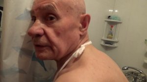 80 лет с одной почкой. НЕФРАСТОМА (нефрастомический дренаж)