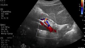 Почему пульсация?