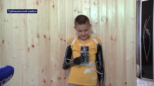 Мальчик из Башкирии, лишившийся конечностей после разряда в 10 тысяч вольт, освоил "железные руки"