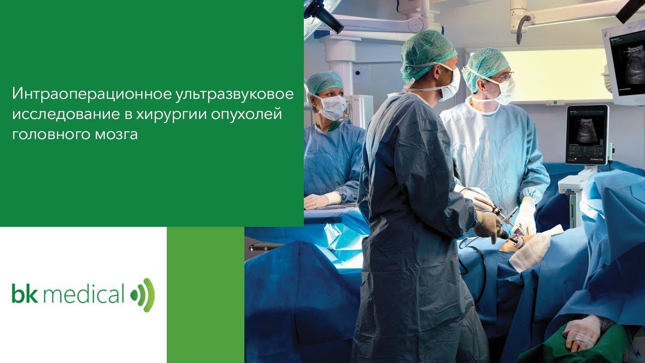 Интраоперационный ультразвуковой контроль резекции опухоли головного мозга