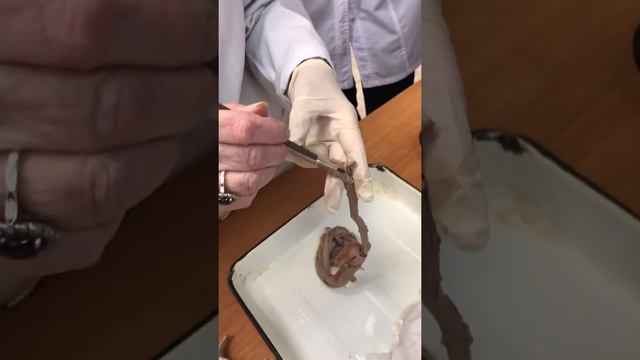 ЦНС. Спинной мозг. Часть 1 смотреть онлайн