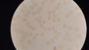 Кровь после соли. Важная информация