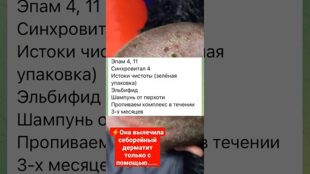 ⚡ОНА ВЫЛЕЧИЛА СЕБОРЕЙНЫЙ ДЕРМАТИТ ТОЛЬКО С ПОМОЩЬЮ....