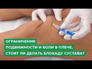 Ограничения подвижности и боли в плече. Стоит ли делать блокаду сустава?