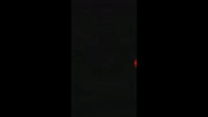 Моя первая большая травма (разсёк бровь)