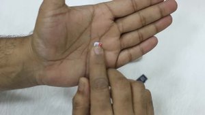 Honor 6X: How to Insert SIM & SD Card