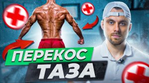 Перекос таза. Коррекция с помощью 5 упражнений