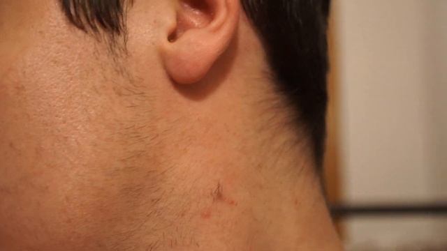 SO MUCH HAIR! (+ Pre-Minox Pics) | Weeks 5 & 6 смотреть онлайн