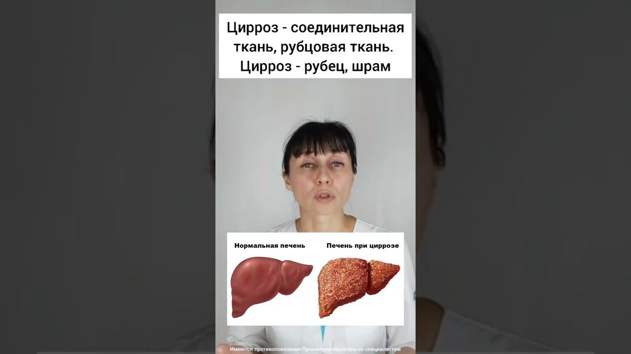 Три причины цирроза печени #shorts