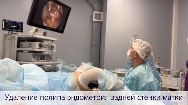 Удаление полипа эндометрия задней стенки матки в клинике PARADA