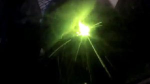 Потолочный операционный шов.mp4