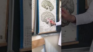 Третий желудочек