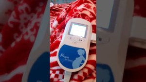 Допплер фетальный Sonoline  C1  3М