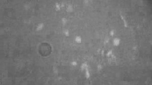 Тромбоциты