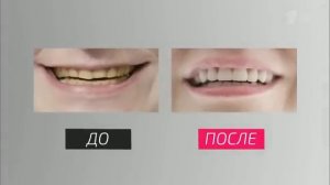 "На 10 лет моложе" 11.06.2016 ~ Na 10 let molozhe (2016)