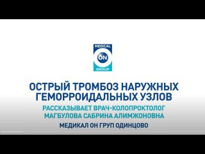 Тромбоз наружных геморроидальных узлов