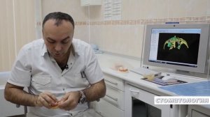 Подробный рассказ врача о протезировании зубов, изготовлении зубных протезов