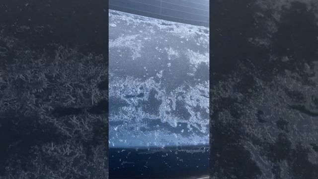 Есди замерз голеностоп а в нкм появился дискомфорт. Боль в голеностопном суставе: причины, лечение в Москве ГОЛЕНОСТОПНЫЙ СУСТАВ - БОЛЬ В ГОЛЕНОСТОПЕ! ПРОПОЛИС НА ВОДЕ! Что делать. Боль в голеностопе - причины появления симптома, способы лечения
