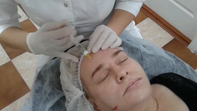 Биоревитализация с помощью иглы и канюли -сочетанная техника