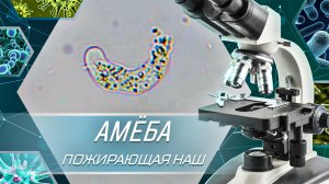 Амеба - Пожирающая наш мозг | Амеба группы LIMAX
