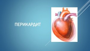 Перикардит