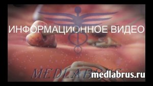 Как ВМС предотвращает беременность?