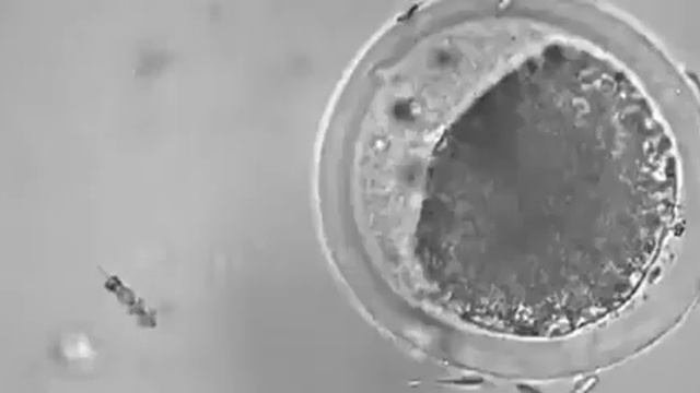 НАНОРОБОТ (NANOROBOT) выполняет искусственное оплодотворение яйцеклетки
