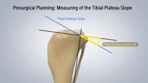 CCL Tears and How a TPLO Surgery Works