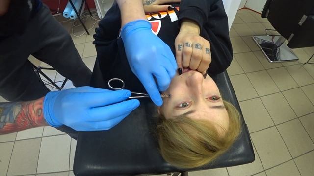 Удаление микродермала ( Microdermal Removal ) смотреть онлайн