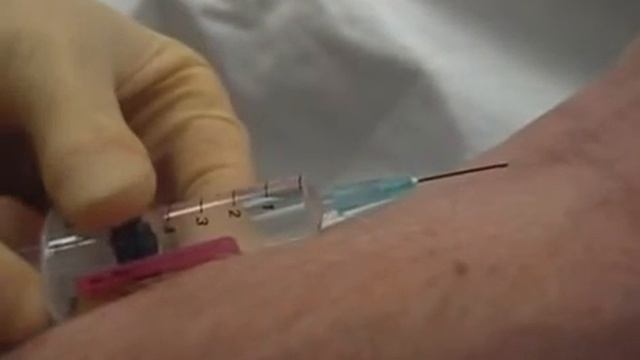 Внутривенная инъекция.