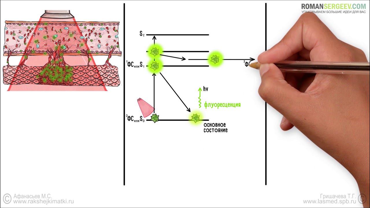 Фотодинамическая диагностика основы и принцип метода презентация