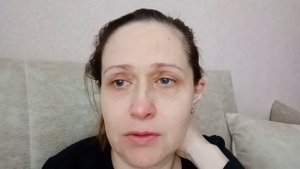 РАССТРОИЛАСЬ: Как же удалить КСАНТЕЛАЗМЫ?