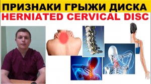 ГРЫЖА ШЕЙНОГО ОТДЕЛА ПРИЗНАКИ Cervical Herniated Disc