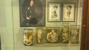 #Уродцы  из #Кунсткамеры  и их история