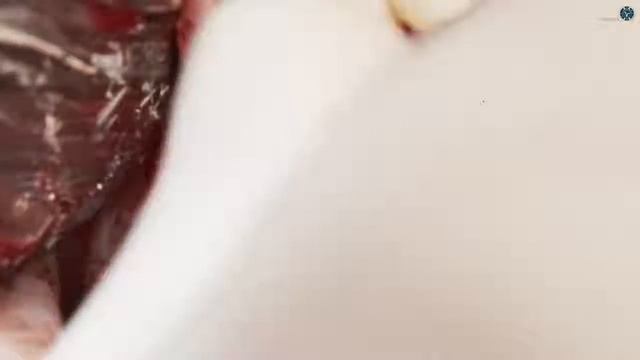 Синус-лифтинг: кейс Олега Пономарева смотреть онлайн