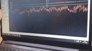 Определяем какая форсунка стучит в нагрузке с помощью фонендоскопа и осциллографа