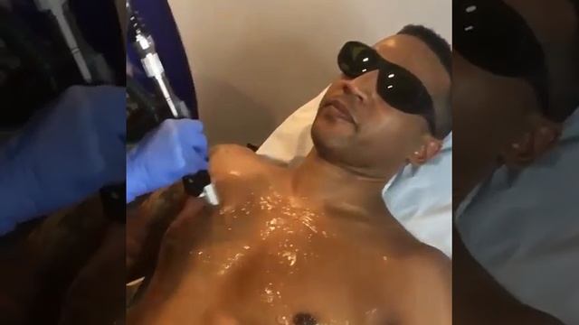 Dr. Paul Frank performs Laser Hair Removal with the Motus AX смотреть онлайн