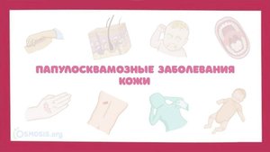 Атопический дерматит, крапивница, псориаз, лишай, себорея - симптомы, лечение (дерматология)