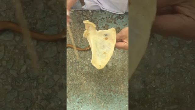 Кости плечевого пояса. Ключица. Лопатка. смотреть онлайн