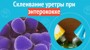 ? Склеивание уретры при энтерококке. Клинический случай №1167