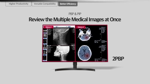LG Medical Display – LG Diagnostic Monitor Line-up смотреть онлайн