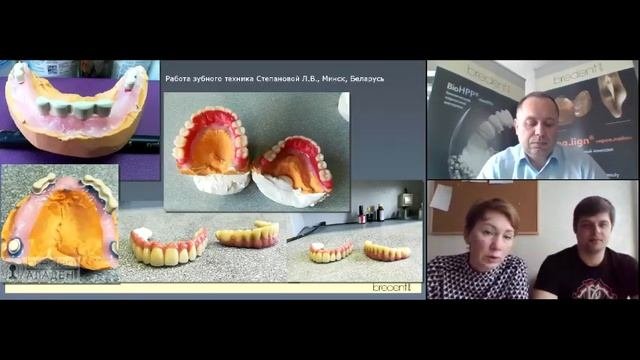 Вебинар №15. Новые материалы для изготовления зубных протезов. Организатор - bredent