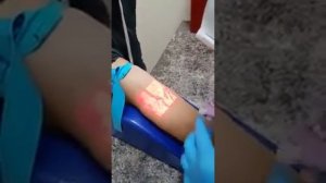 Вот так на западе пациенту ищут вену  С реформами Супрун, конечно не сравнить