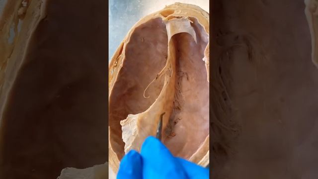 What’s Inside This REAL Human Skull?